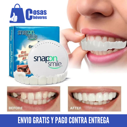 Carillas Dentales SnapOn Smile